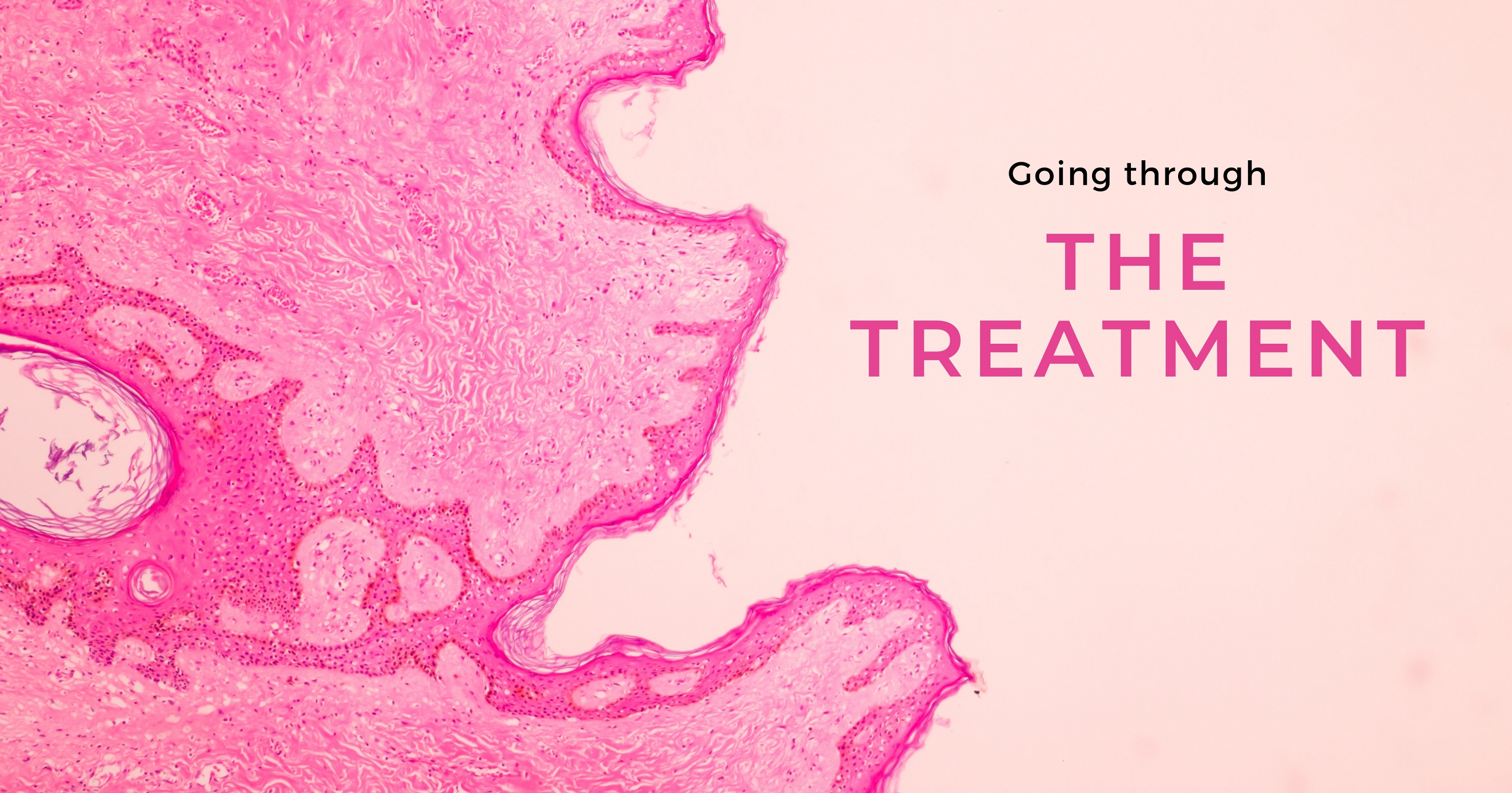 Going through the breast cancer treatment